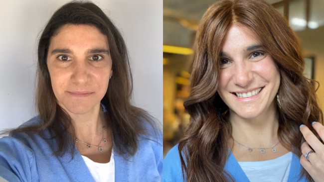 Woman with thinning hair wearing a realistic wig