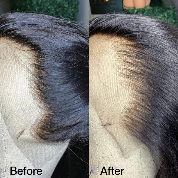 Before and after plucking wig hairline